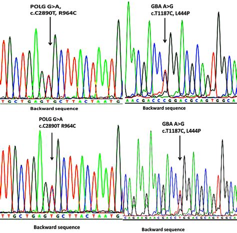 Sequence Chromatograms Showing The Single Nucleotide Change In Gba And