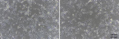 U87mg细胞 人脑星形胶质母细胞瘤株购买价格、培养基、培养条件、细胞图片、特征等基本信息生物风