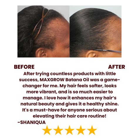 how to use batana oil for hair growth