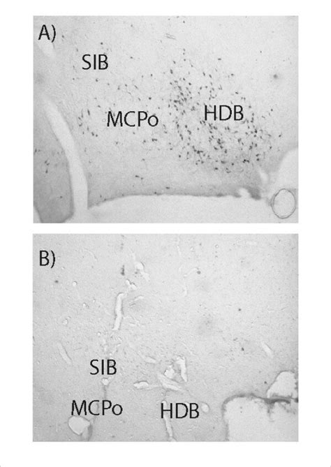 Photomicrographs Illustrating The Extent Of Chat Positive Neuronal Loss