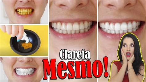 10 MANEIRAS DE CLAREAR OS DENTES EM CASA NATURALMENTE EM 2 MINUTOS