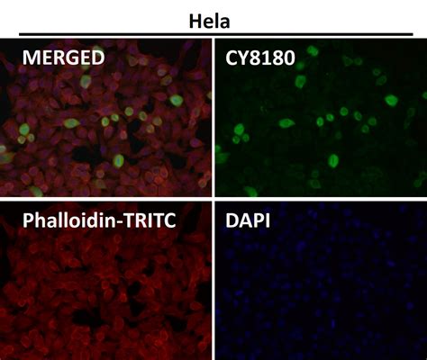 Atp Dependent Rna Helicase A Ab Abways