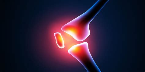 The FAQs of Knee Cartilage Surgery and Recovery | Rothman Orthopaedics