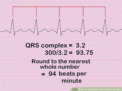 How To Calculate Heart Rate From Ecg 8 Steps With Pictures