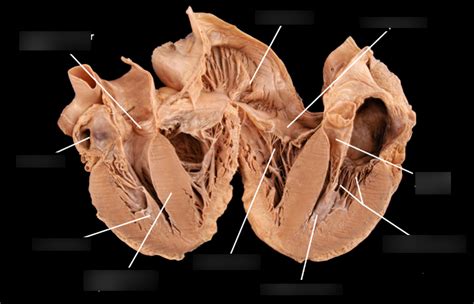 Sheep Heart Inside Diagram Quizlet