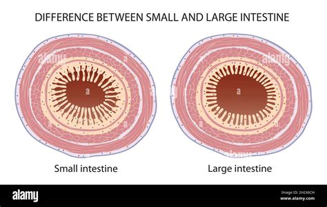 Diferencia entre el intestino delgado y el intestino grueso Fotografía