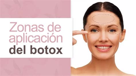 coro periscopio Poner botox ojos hinchados Misionero Contradicción esponja