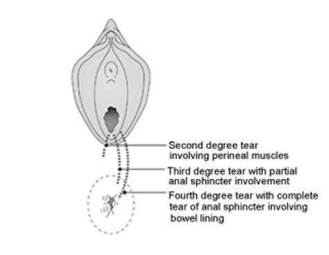 Pin On Post Natal Pilates