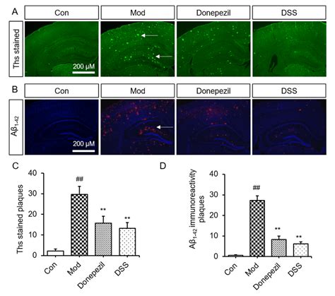 Dss Reduces Aβ Amyloidosis In The Brain Of App Ps1 Mice Representative