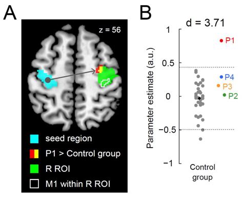 Brain Sciences Free Full Text Functional And Structural Properties Of Interhemispheric