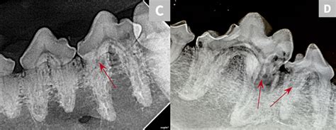 Image Gallery Dental Radiography Clinician S Brief