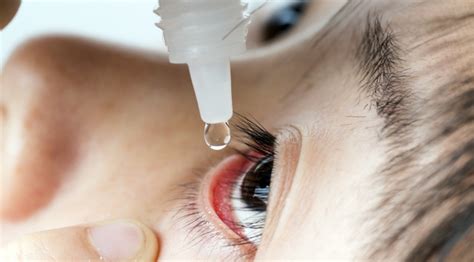 Study Finds Low Dose Atropine Eye Drops Ineffective For Preventing