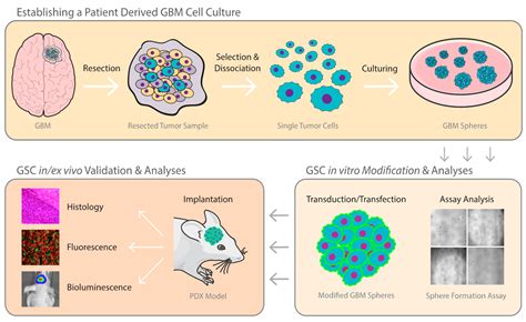 Cells Free Full Text Patient Derived Glioma Models From Patients