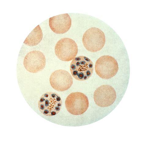 Free picture: erythrocyte, contains, merozoites, released, develop, male, female, gametocytes