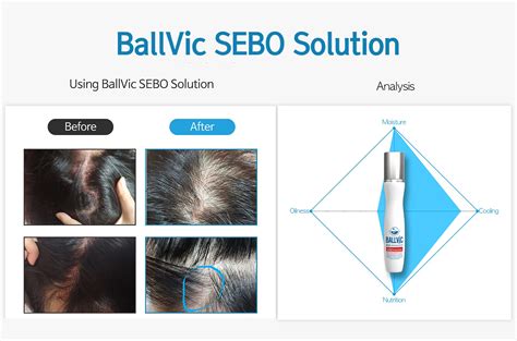 Mua Ballvic Sebo Solution Dandruff Itchy Scalp Care Seborrheic