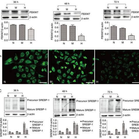 Overexpression Of Fbxw Decreases Srebp Expression In Hkc Cells A