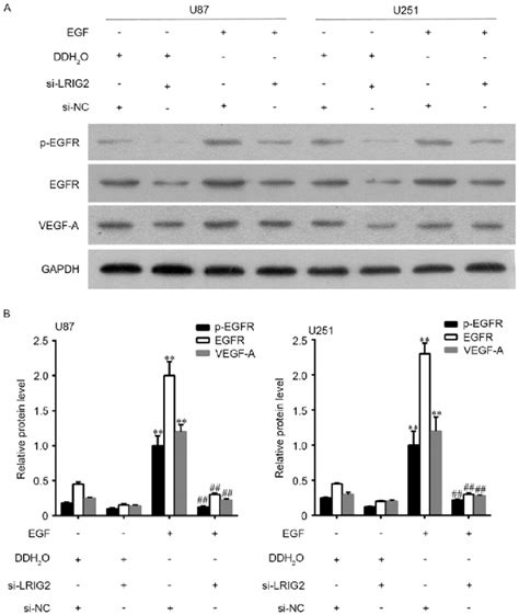 U87 And U251 Cell Lines Were Transfected With Si‑lrig2 Or Si‑nc Then Download Scientific