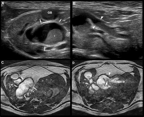 Normal abdominal wall, peritoneum and fat - Small Animal Ultrasonography