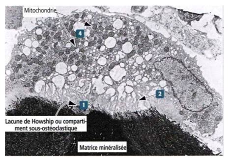 Lacunes De Howship Ue Histologie Bdr Tutorat Associatif Toulousain