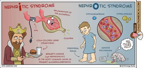 Diferencias entre Síndrome Nefrítico y Síndrome Nefrótico. # ...