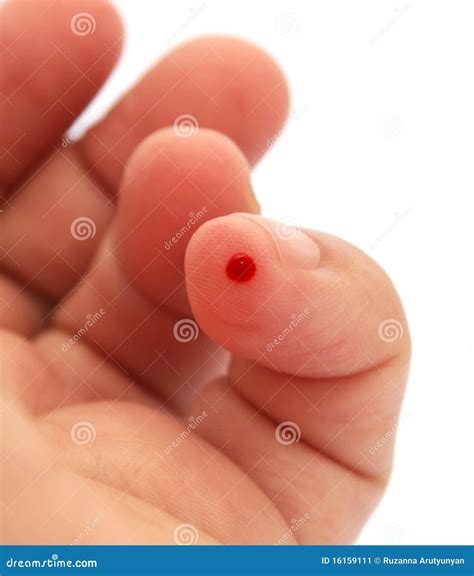 Bleeding Finger Stock Image Image 16159111