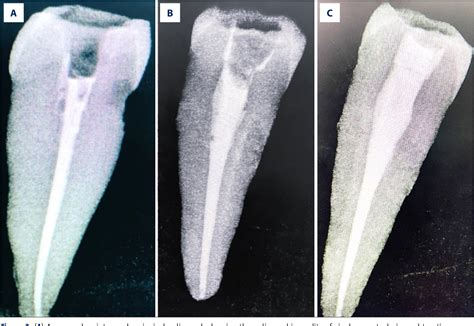 Figure 1 From A Scanning Electron Microscopy Study Comparing 3