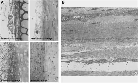 The structure of the perichondrium. (A) Cartilage and perichondrium ...