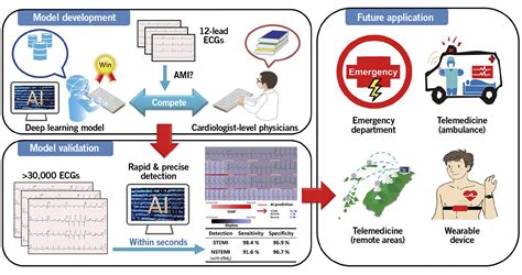 A Deep Learning Algorithm For Detecting Acute Myocardial Infarction