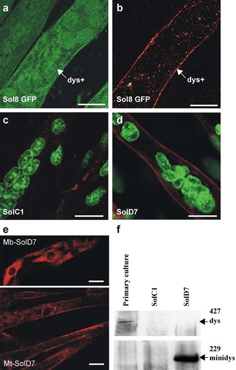 Expression Of Dystrophin And Minidystrophin After Transfection Of Sol