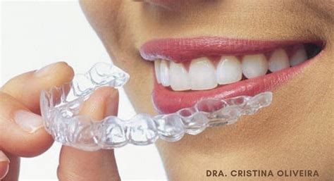 Transforma Tu Sonrisa Con Invisalign Adipiscor