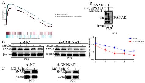 Gnpnat Serves As A Prognostic Biomarker Correlated With Immune