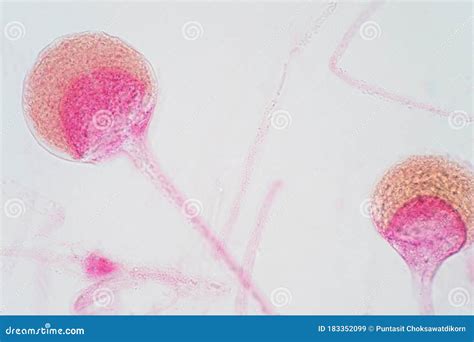 Rhizopus Bread Mold Under The Microscope Stock Image Image Of