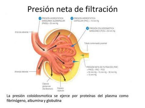 PRESION NETA DE FILTRACION PNF YouTube