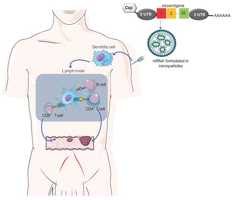 Advances in mRNA-Based Cancer Vaccines