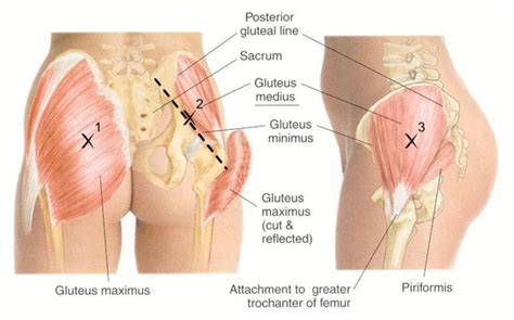 Weak Glutes