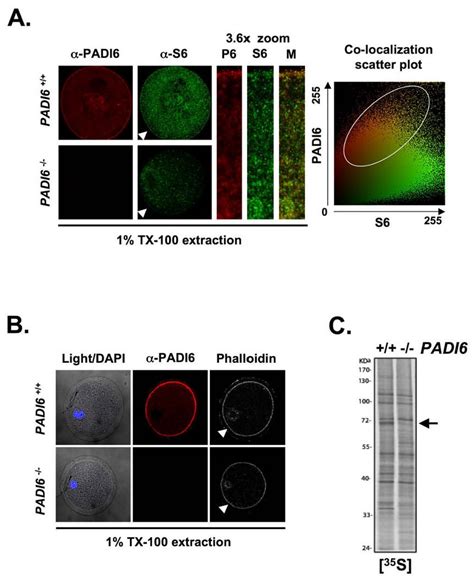 Loss Of Padi6 Alters The Levels And Localization Of Ribosomal Protein