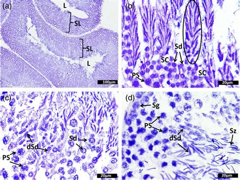 Spermatogenesis And Morphological Changes Of P Sinensis He Staining