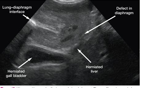 Feline Abdominal Ultrasonography Whats Normal Whats Abnormal The