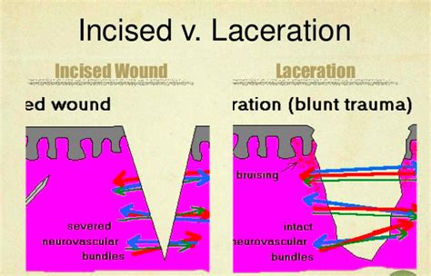 Blade Damage Knife Wounds Graphic Fightwrite