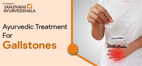 What Are Gallstones Their Causes Symptoms And Ayurvedic Treatment