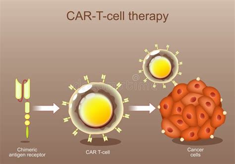 Car T Cell Therapy Cancer Immunotherapy Stock Vector Illustration Of