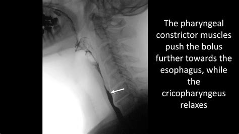 Normal Barium Swallow Esophageal