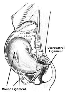 Round Ligament