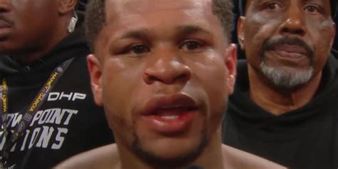 Devin Haney Addresses Broken Jaw Claims After Ryan Garcia Loss