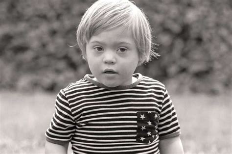 How Exercise Benefits People With Downs Syndrome