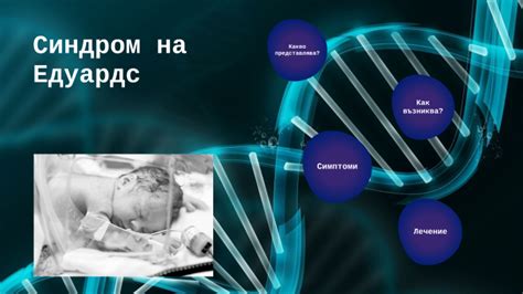 Синдром на Едуардс by Nikol Alexandrova on Prezi