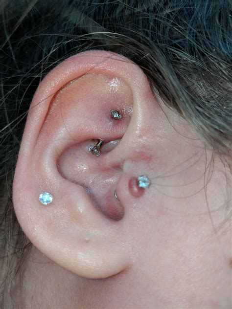 Swollen Tragus Piercings Causes And Treatment 50 Off