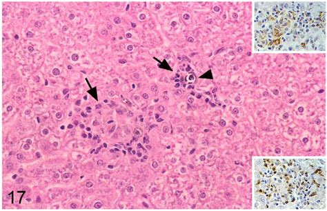 Field Vole With M Microti Tuberculosis Liver With Small Focal