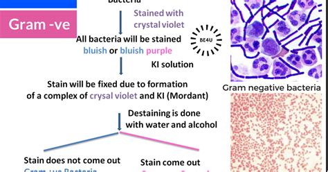 Example of Gram Negative Bacteria | ExamplesOf.net