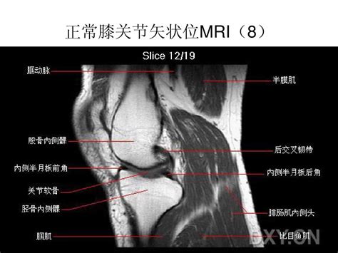 膝关节mri解剖 Word文档在线阅读与下载 无忧文档